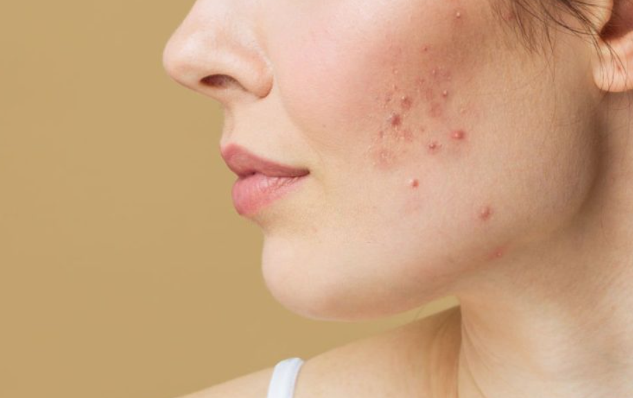 He Thought It Was Allergy – Truth Shocked Him