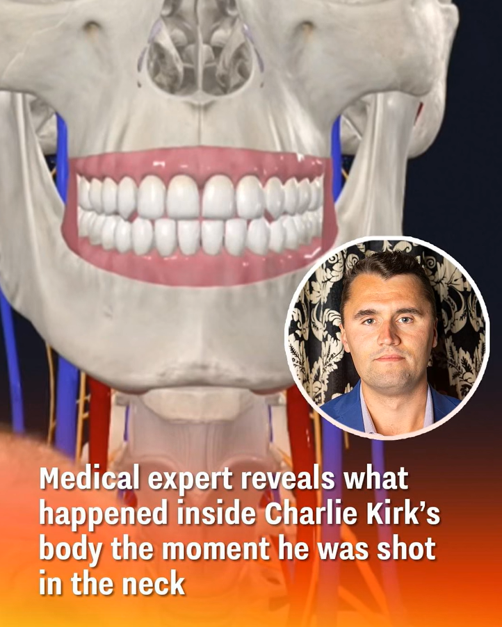 Charlie Kirk Shooting: What Happened in His Body