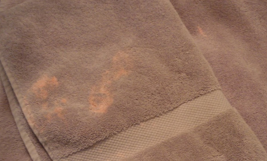 The Real Reason Some Clothes Get Discolored