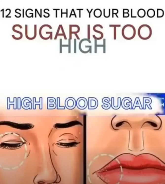 12 Early Signs Your Blood Sugar Is Too High