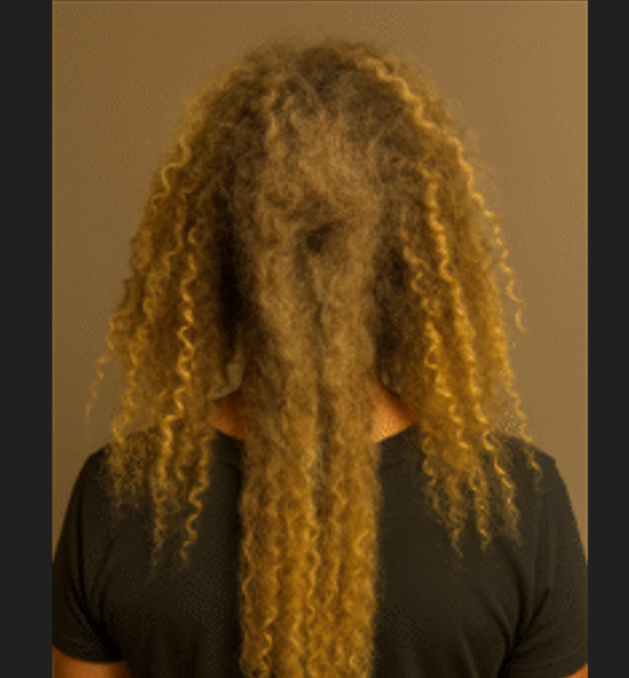 The Surprising Benefits of Apple Cider Vinegar You Didn’t Know