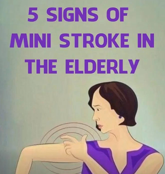 Mini-Stroke Alerts: Changes in Your Body You Shouldn’t Ignore