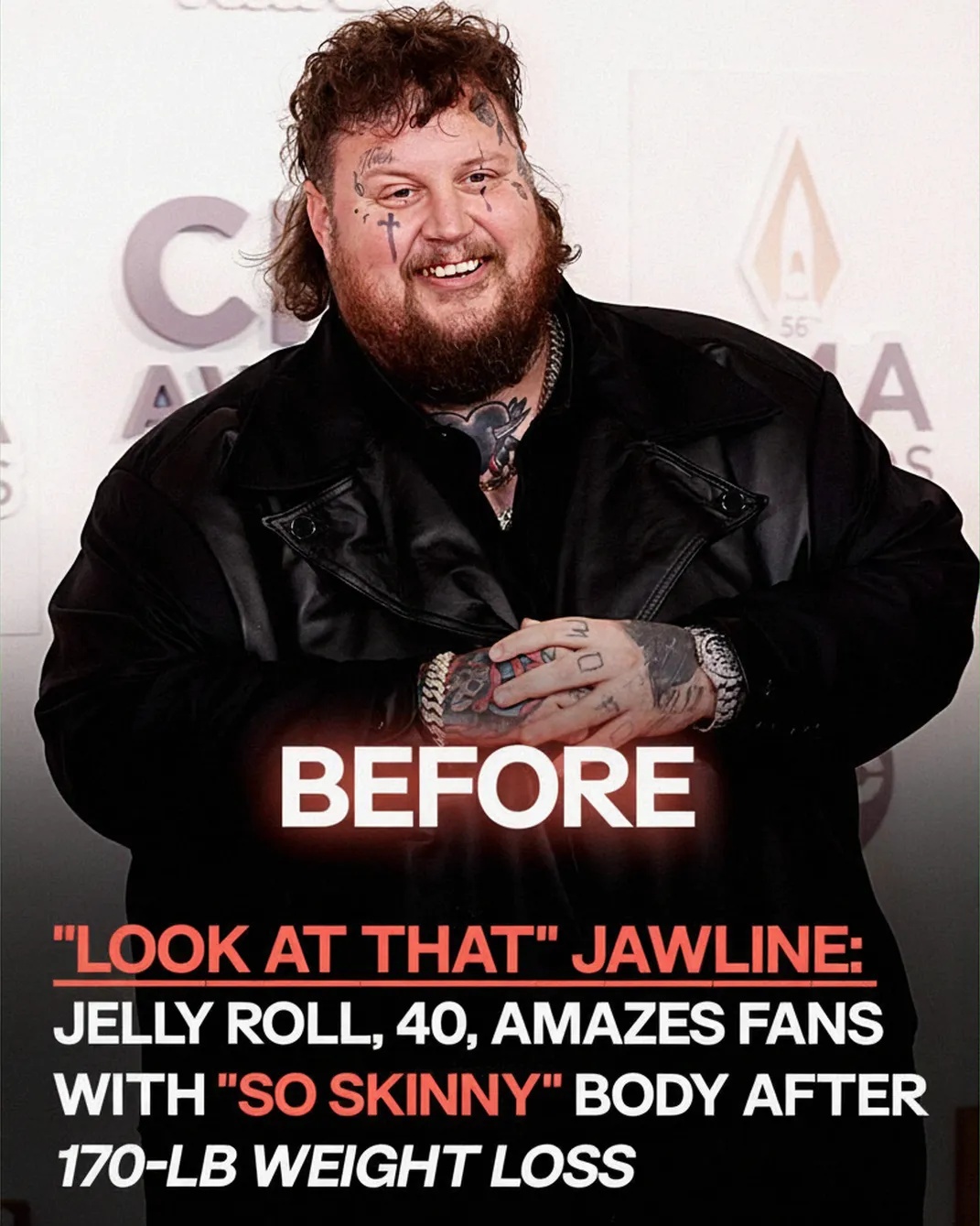 Jelly Roll’s Jaw-Dropping Weight Loss Transformation Goes Viral