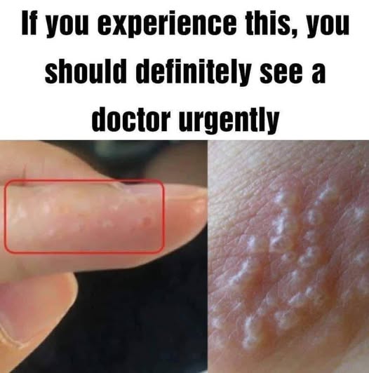 Noticing Itchy Red Bumps? Here’s What They Might Mean