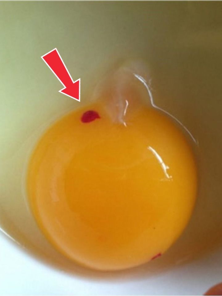 What Red Spots in Eggs Mean — and Whether They’re Safe to Eat
