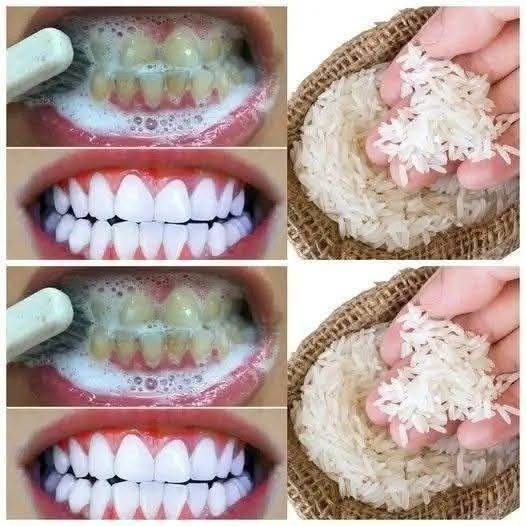 Does Rice Help Whiten Teeth? A Look at a Trending Home Method