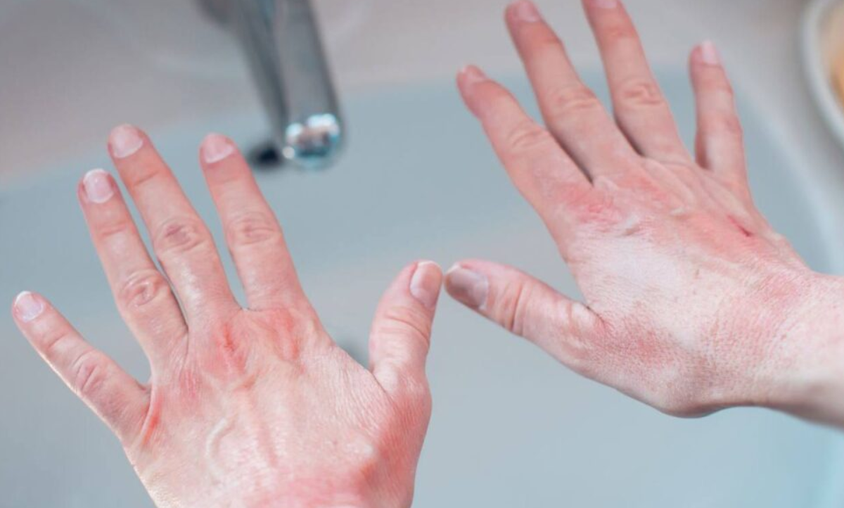 What Happens When You Sleep Too Cold