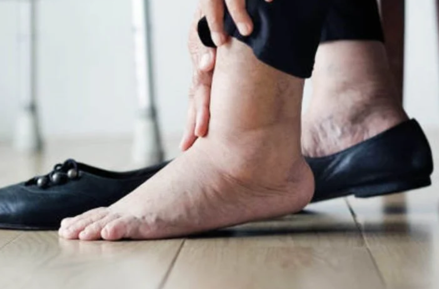 Why Skin Changes Like Redness or Itching on the Legs Can Occur