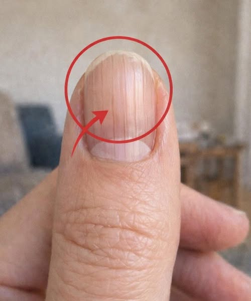 Fingernail Clues: What Experts Say About Your Overall Well-Being