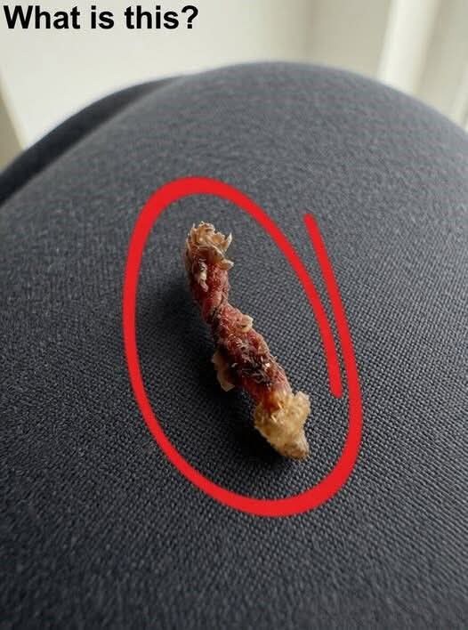 Middle-of-the-Night Sensation Made Me Think Something Was on My Skin