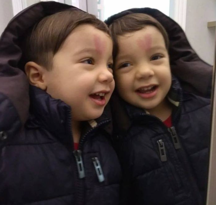From Viral Newborn to Growing Up: The Birthmark Story