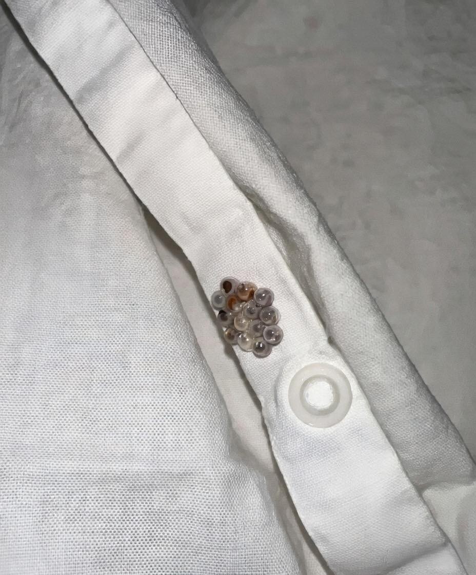 Strange Objects Found in Bedding Lead to a Simple Explanation