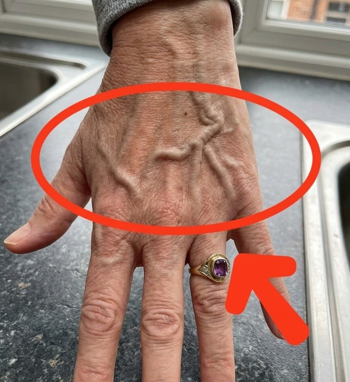 Why Veins Become More Visible and What It Can Mean for Your Health