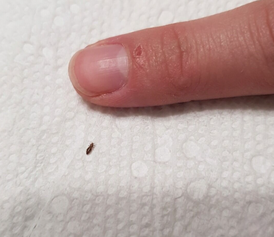Tiny Bug Found in Toddler’s Hair? What Parents Should Know About Head Lice