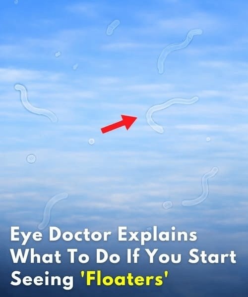 Understanding Eye Floaters and Flashes: Signs You Shouldn’t Ignore