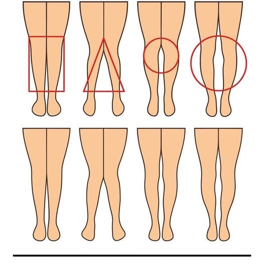 What Your Legs May Be Revealing About Your Health: Surprising Signs You Shouldn’t Ignore