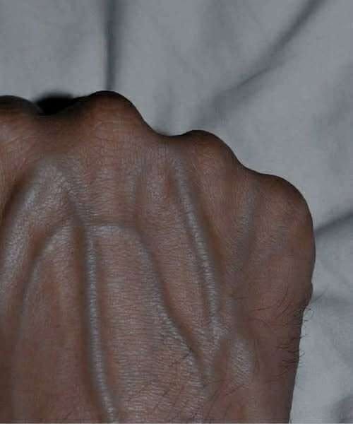 Visible Veins? Here’s What They Could Be Telling You About Your Health
