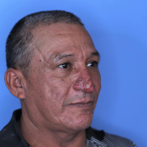 Man’s Life Transformed After Receiving a Long-Awaited Reconstructive Surgery Before the Holidays