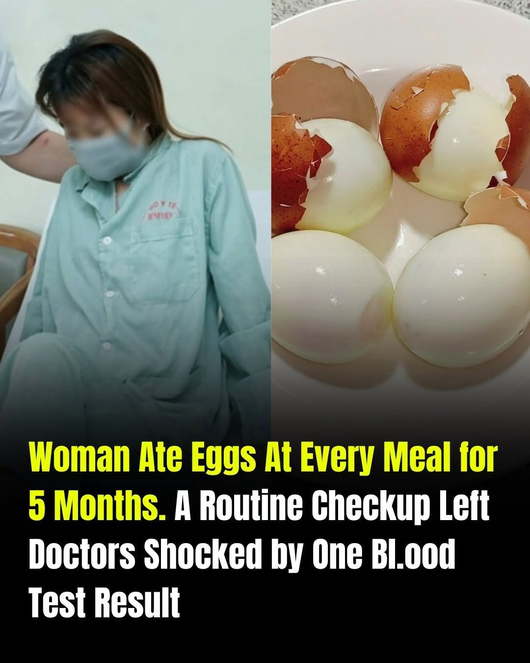 A Five-Month Egg-Only Diet Led to Unexpected Health Findings, Highlighting the Importance of Balanced Nutrition