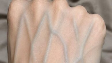 Understanding Visible Hand Veins: Common Causes and When to Consult a Healthcare Professional