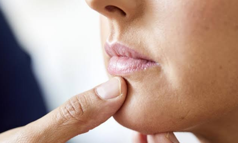 Why Some Women Develop Chin Hair and What It Can Sometimes Indicate