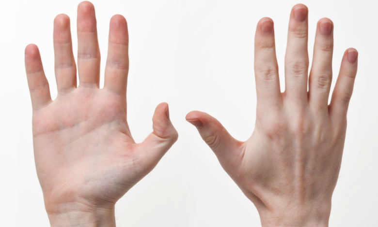 What the Letter “M” on Your Palm Means and Why Many People Find It Interesting